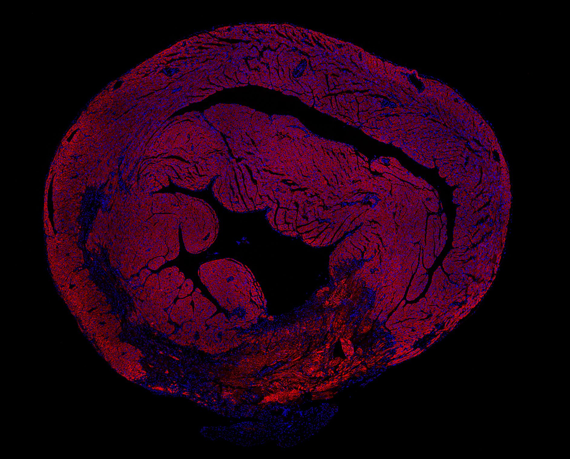 Microscopy image of a heart tissue section, with intricate red fibers and blue puncta against a black background.